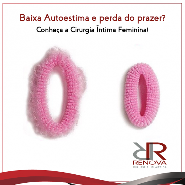 cirurgia-intima-vagina-renova-df