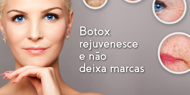 botox-renova-clinica-df