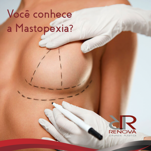 mastopexia_renova_clinica