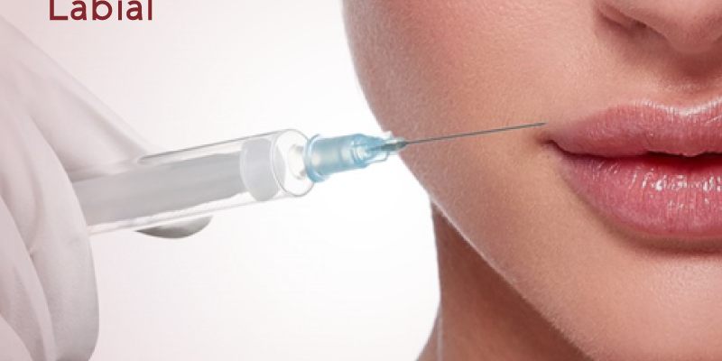 preenchimento-labial-renova-df