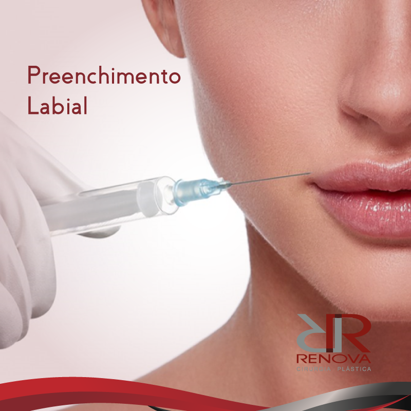 Preenchimento Labial Clínica Renova Agende Uma Avaliação