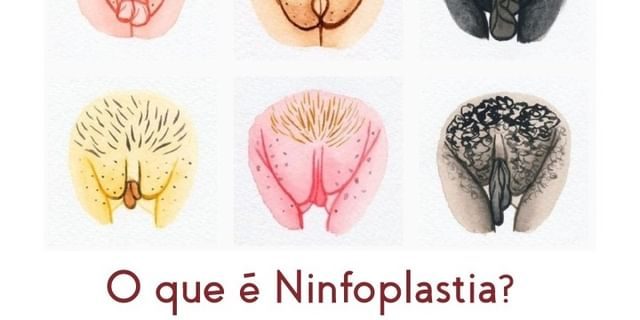 Ninfoplastia O que é Clínica Renova Cirurgias Plásticas