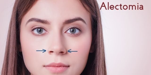 rinoplastia-x-alectomia-clinica-renova-df Rinoplastia x alectomia Clínica Renova DF