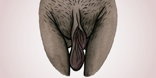 pequenos lábios hipertrofia sua clinica renova df